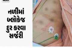 *ગુજરાતમાં પ્રથમવાર રોબોટિક કાર્ડિયાક સર્જરી:* અમદાવાદની સીમ્સ હોસ્પિટલમાં 77 વર્ષીય વૃદ્ધ પર TECAB સફળ રહ્યું, હૃદયની આસપાસ કાણાં પાડી સર્જરી પાર પાડી
https://divya-b.in/mW5TUEdlBIb