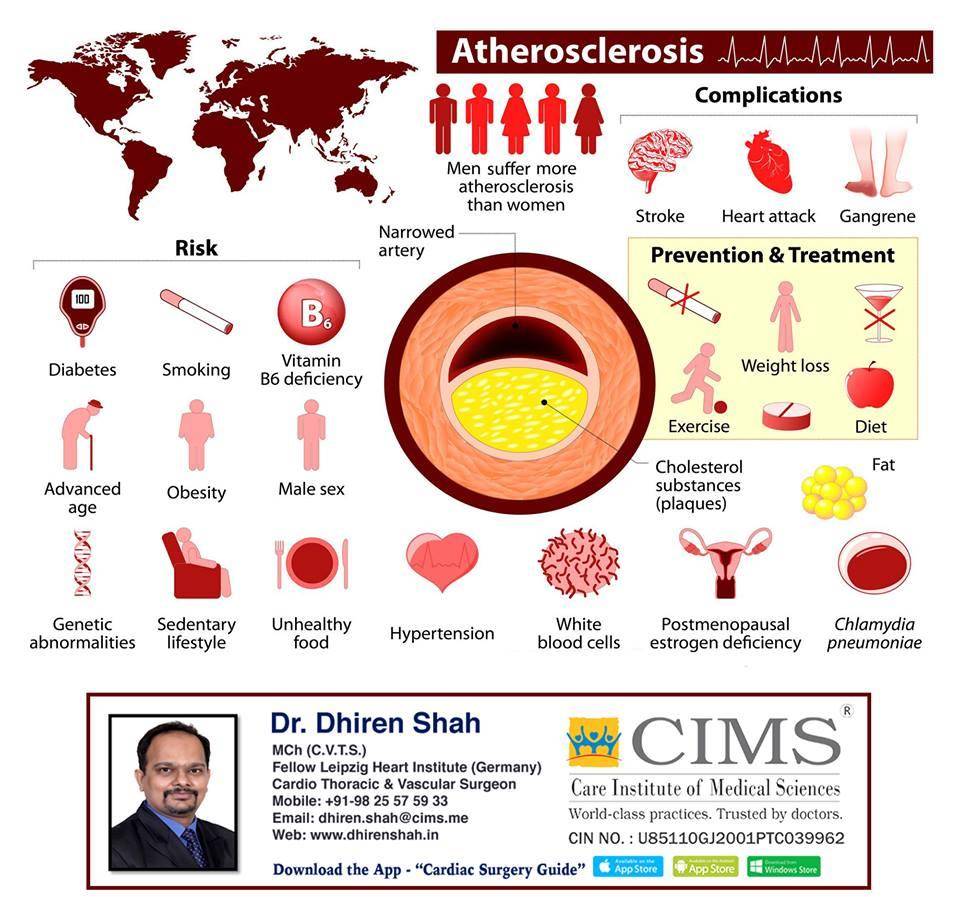 atherosclerosis