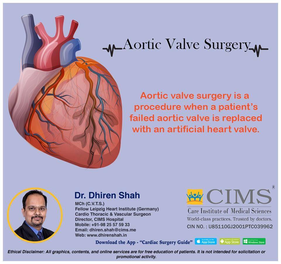 Aortic Valve Surgery