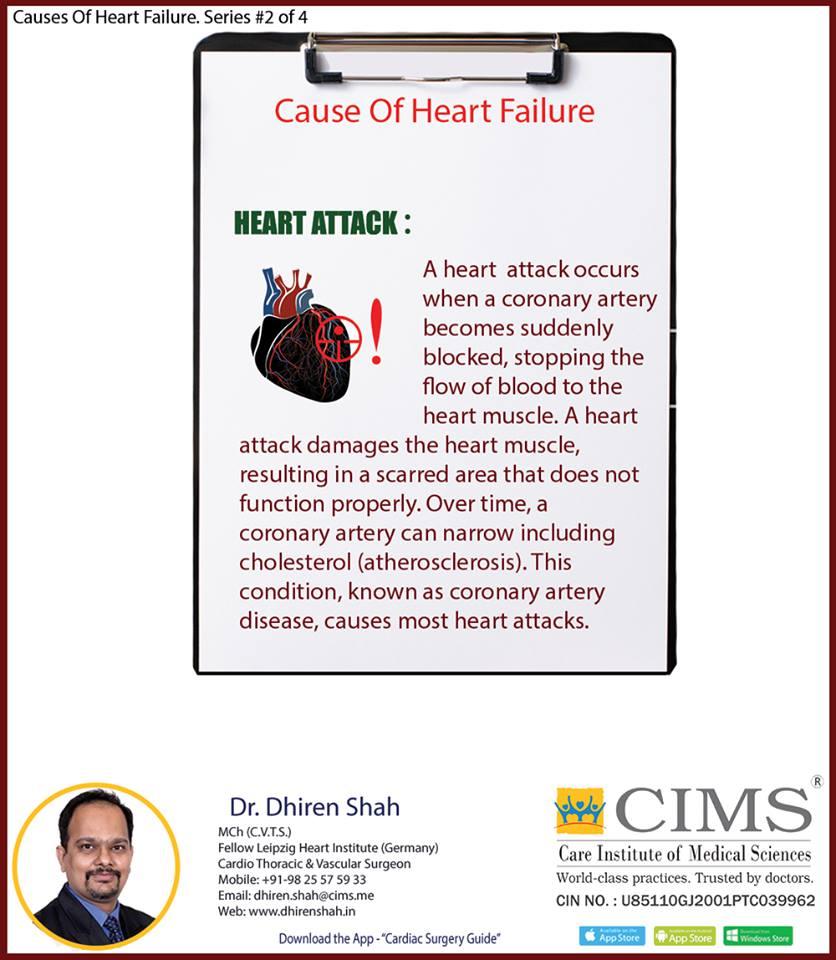 Causes Of Heart Failure