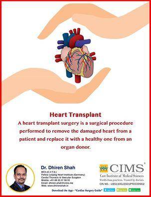 Heart Transplant