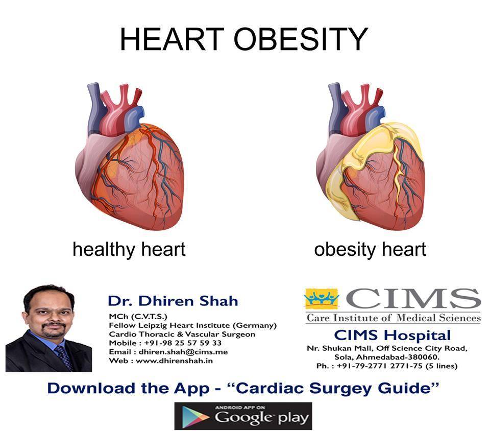 heart obesity