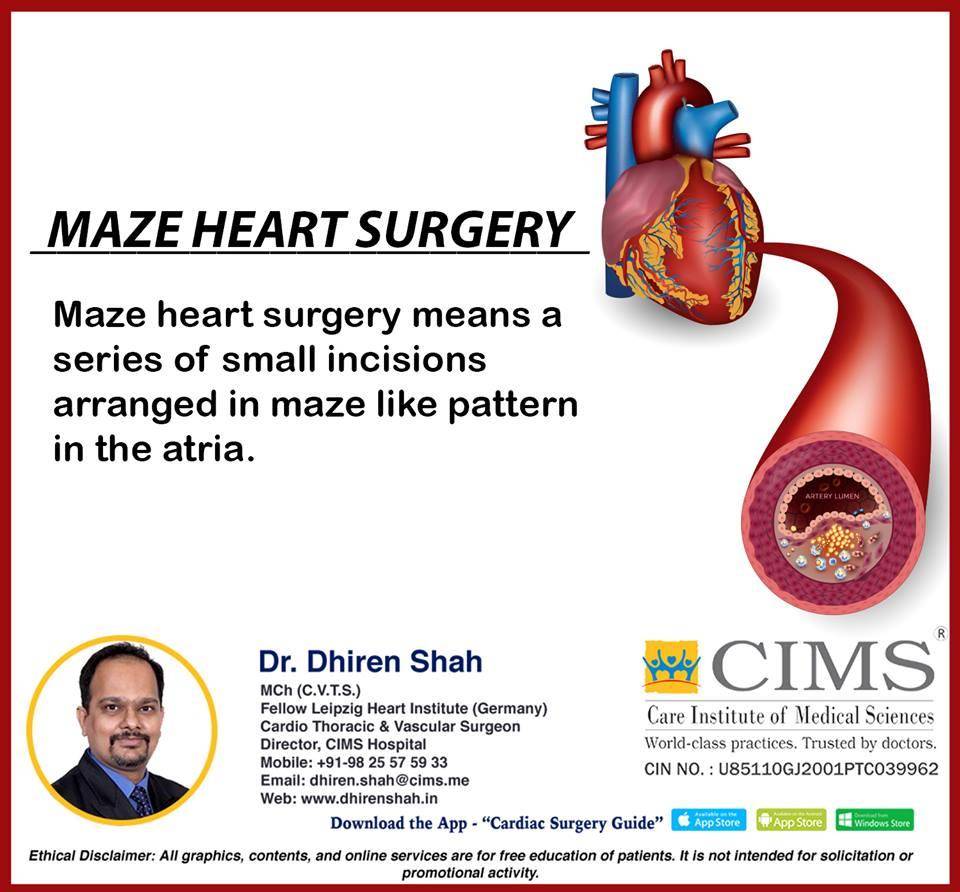 Maze heart surgery