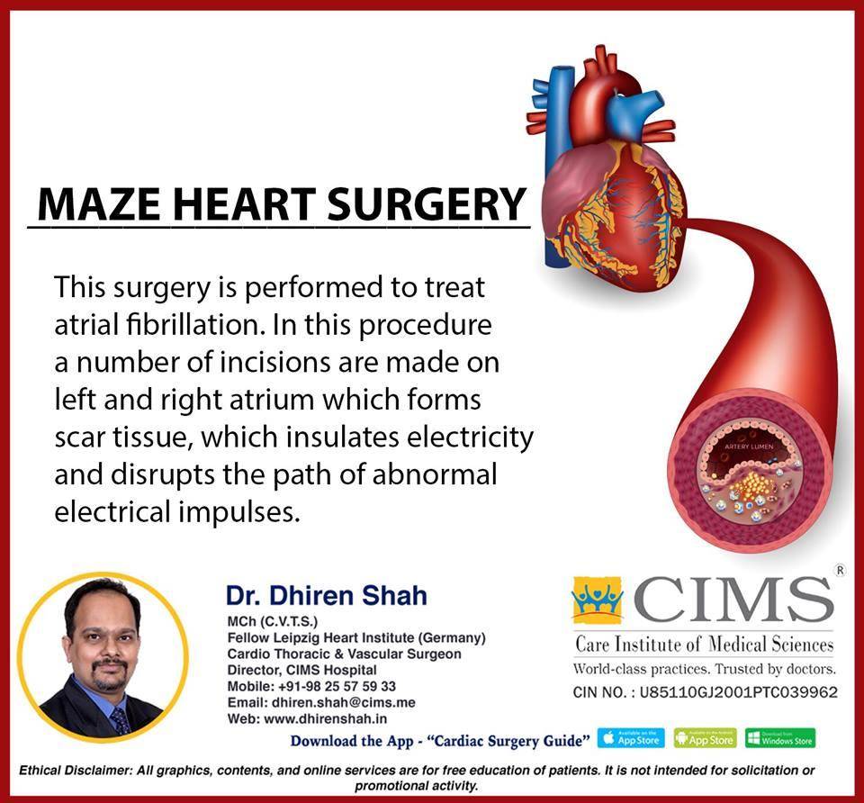 Maze Heart Surgery