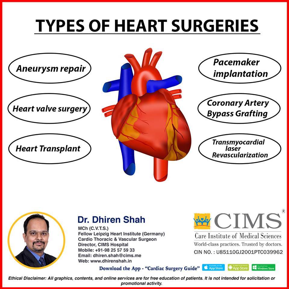 Types Of Heart Surgeries