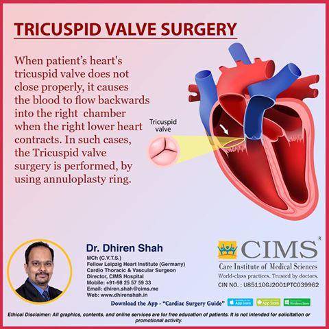 tricuspid valve surgery