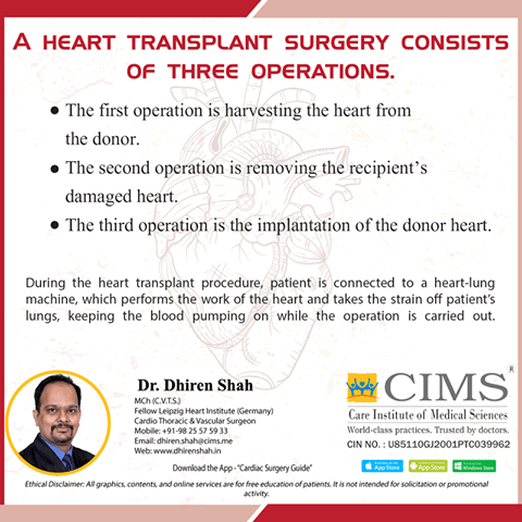 A heart transplant surgery consists of three operations