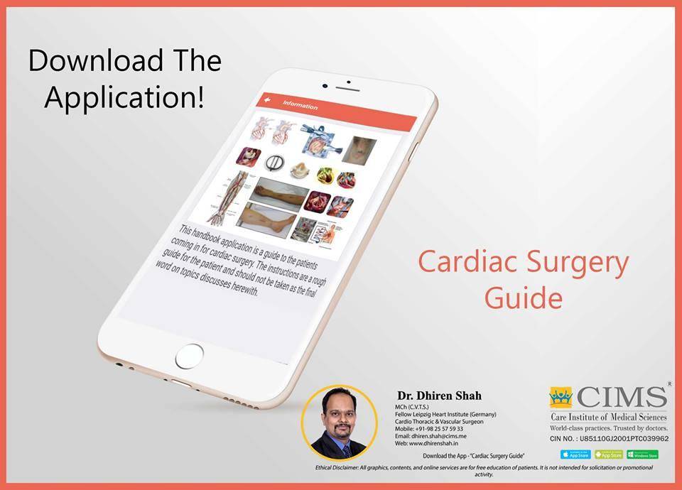 Cardiac surgery guide