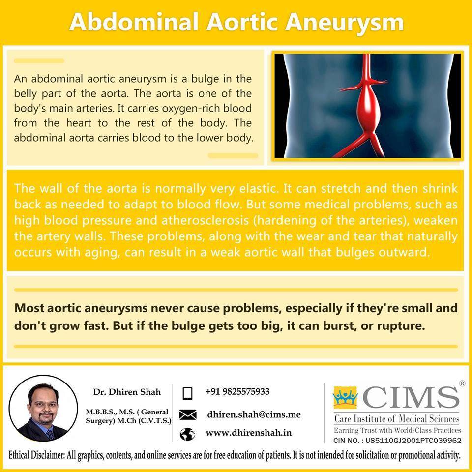 Abdominal aortic aneurysm