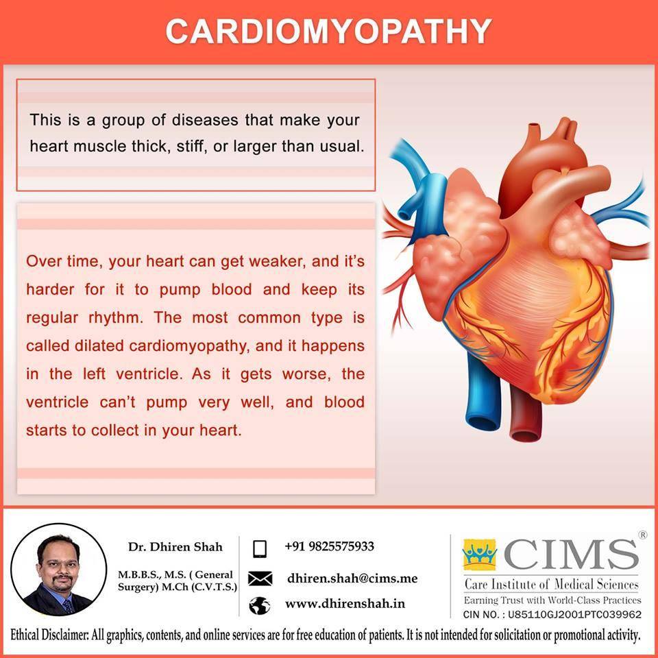 CARDIOMYOPATHY