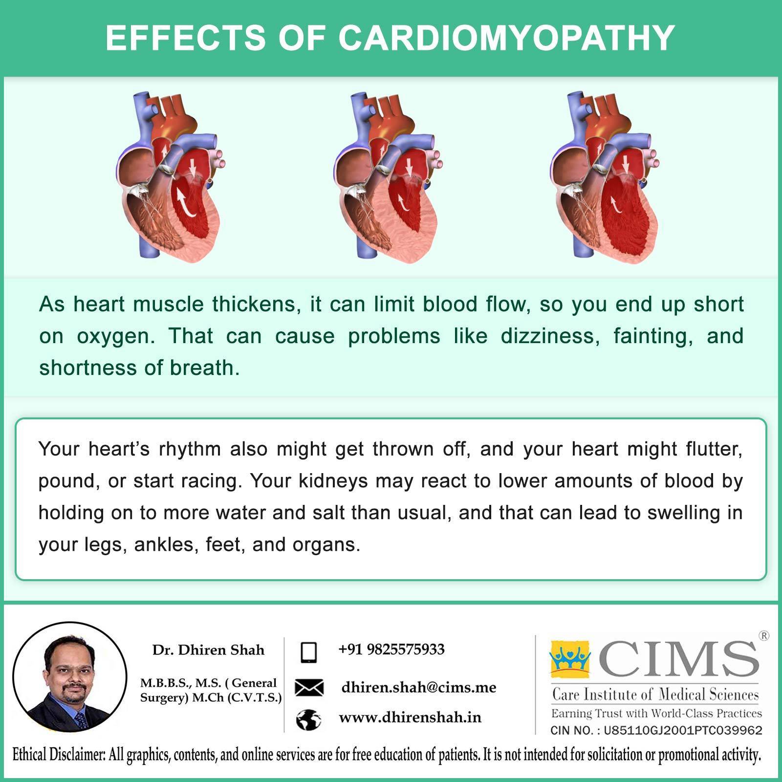 EFFECTS OF CARDIOMYOPATHY.