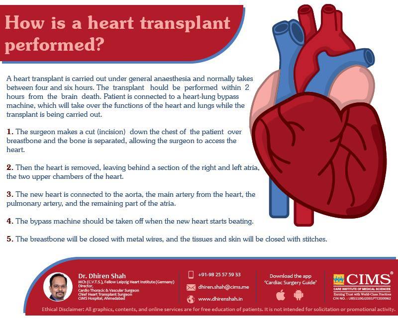 how is heart trasplant performed?