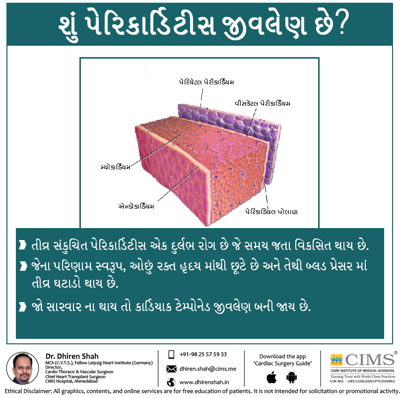 શું પેરિકાર્ડિટીસ જીવલેણ છે ?