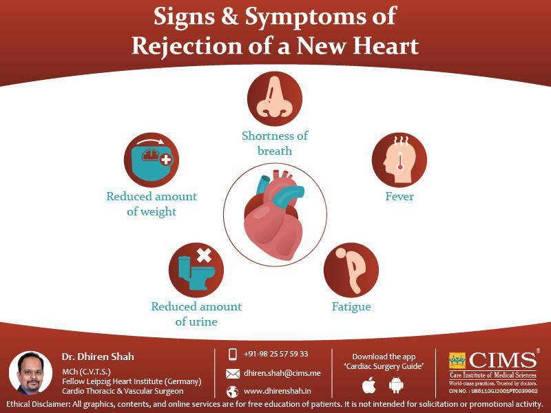 Signs & Symptoms of Rejection of New Heart