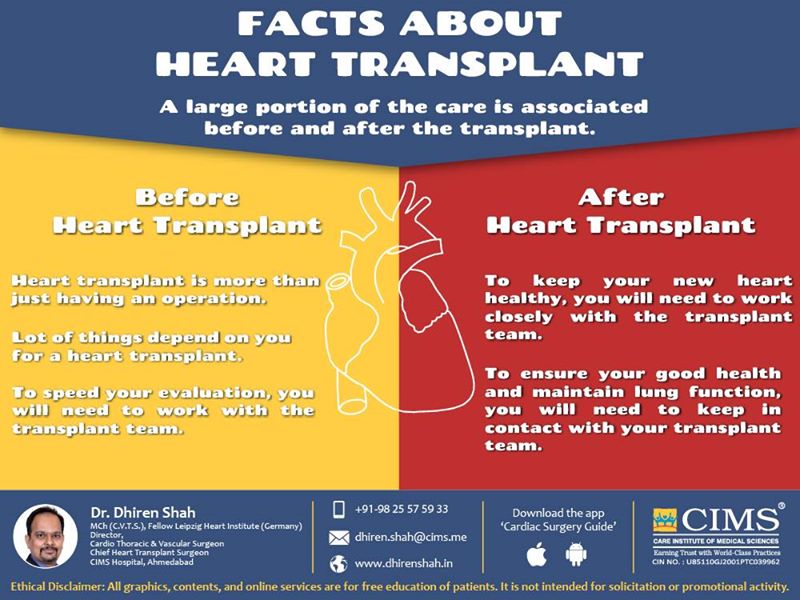 Facts About Heart Transplant  