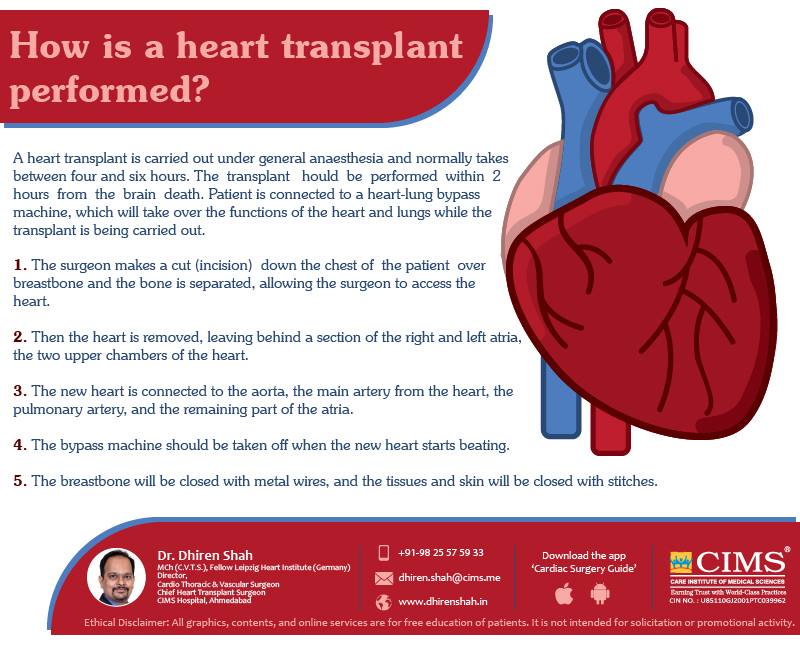 How Is a Heart Transplant Performed ?