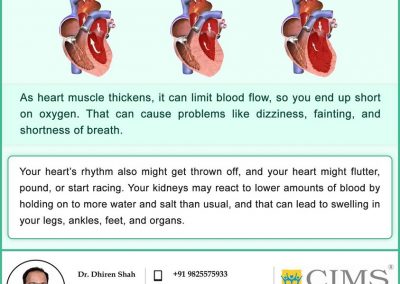 EFFECTS OF CARDIOMYOPATHY.