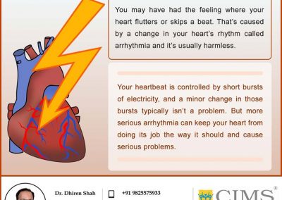 ARRHYTHMIA