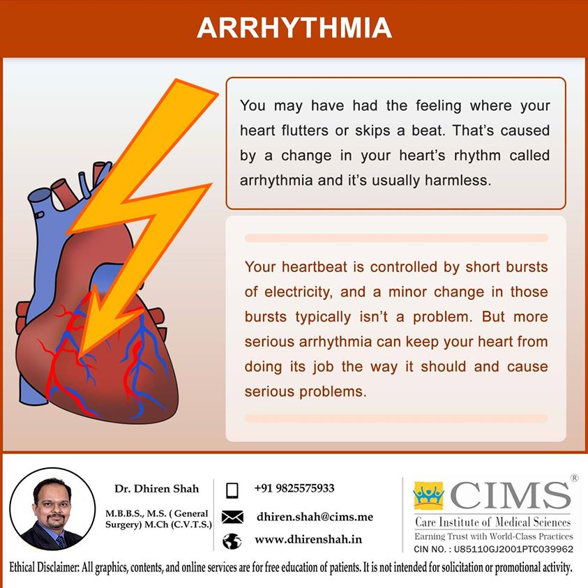 ARRHYTHMIA