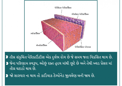 શું પેરિકાર્ડિટીસ જીવલેણ છે ?