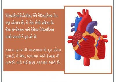 પેરિકાર્ડિઓસેન્ટેસીસ શું છે?