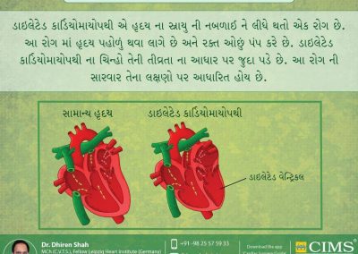 ડાઇલેટેડ કાર્ડિયોમાયોપથી શું છે?