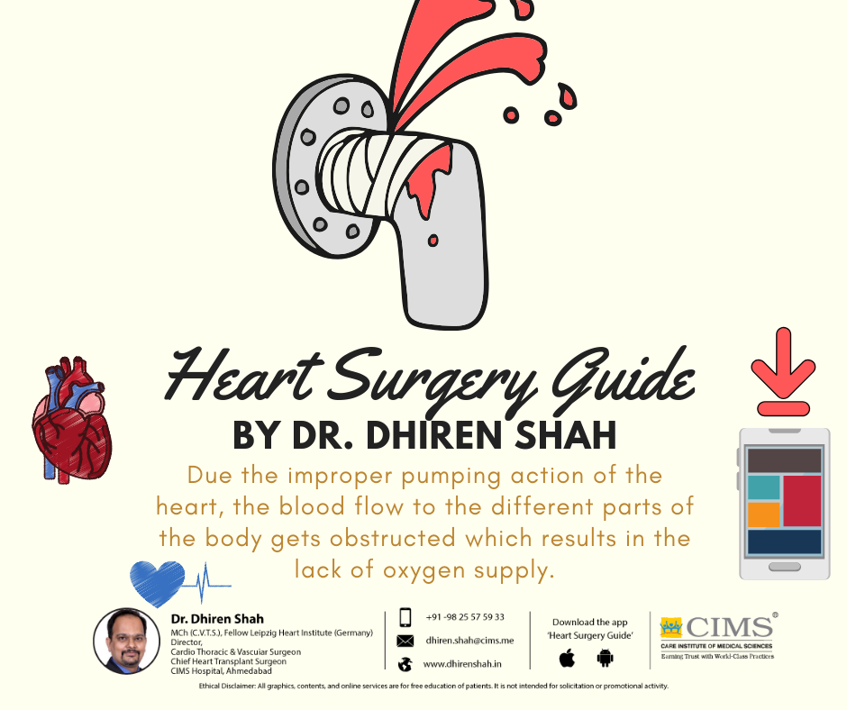 Heart Surgery Guide By Dr.Dhiren Shah