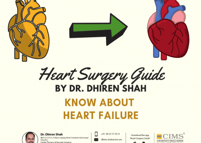 Heart Surgery Guide By Dr.Dhiren Shah