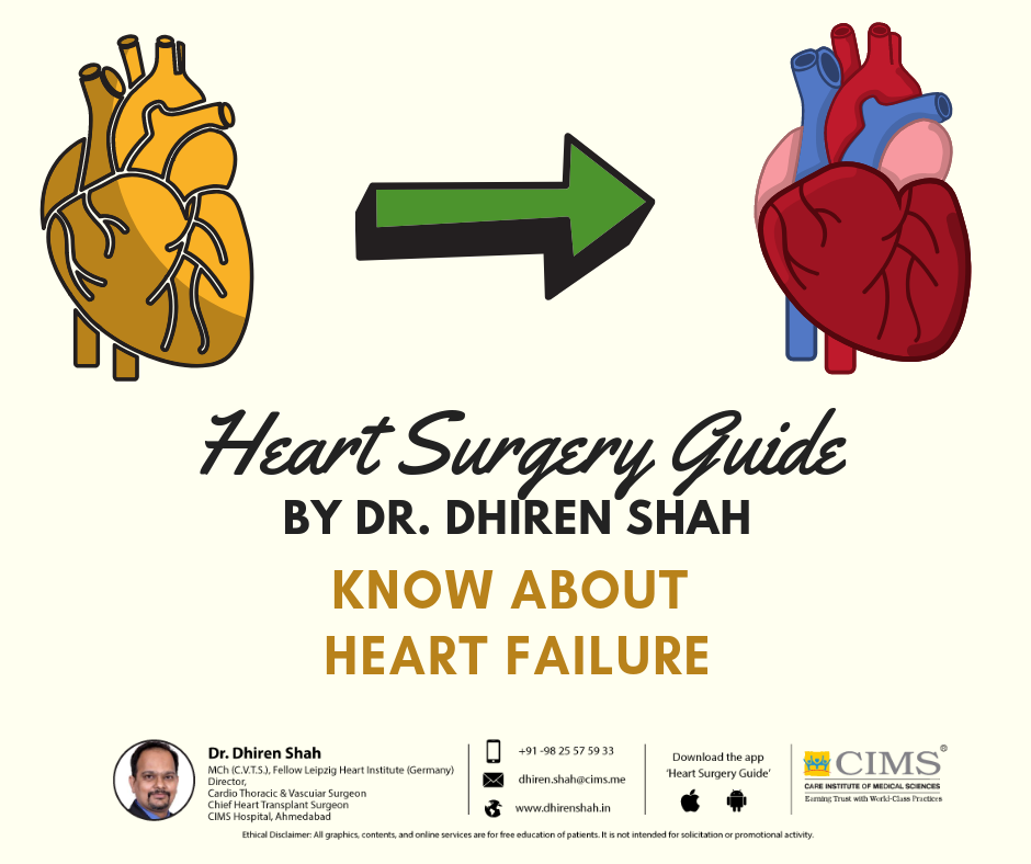 Heart Surgery Guide By Dr.Dhiren Shah