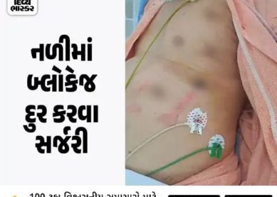 *ગુજરાતમાં પ્રથમવાર રોબોટિક કાર્ડિયાક સર્જરી:* અમદાવાદની સીમ્સ હોસ્પિટલમાં 77 વર્ષીય વૃદ્ધ પર TECAB સફળ રહ્યું, હૃદયની આસપાસ કાણાં પાડી સર્જરી પાર પાડી https://divya-b.in/mW5TUEdlBIb
